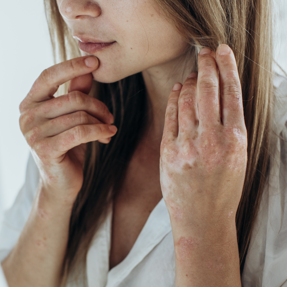 Best Face Eczema Products 2026: Gentle Formulas for Sensitive Facial Skin