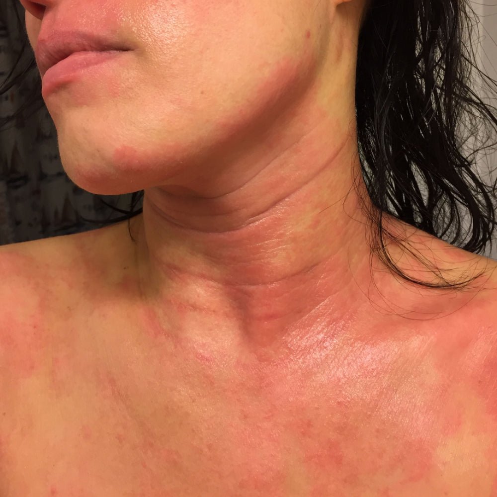 TSW Healing Stages: All You Need to Know - Phoilex