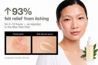93% felt relief from itching — as reported in the New York Post thumbnail