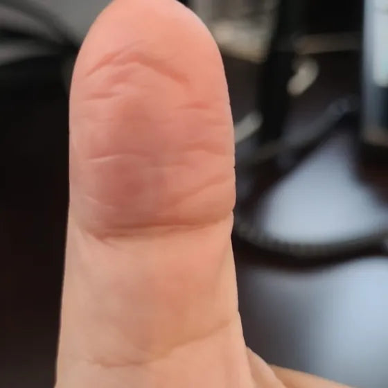 Customer photo, thumb, after