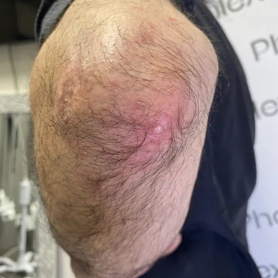 Customer photo, elbow, before