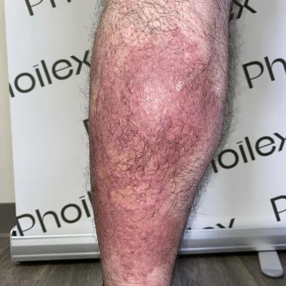 Customer photo, calf, before