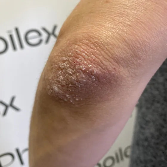 Customer photo, elbow, before