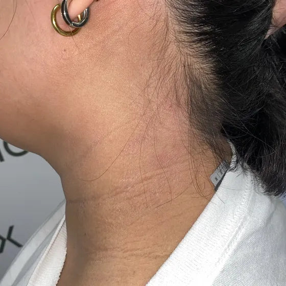 Customer photo, neck, before
