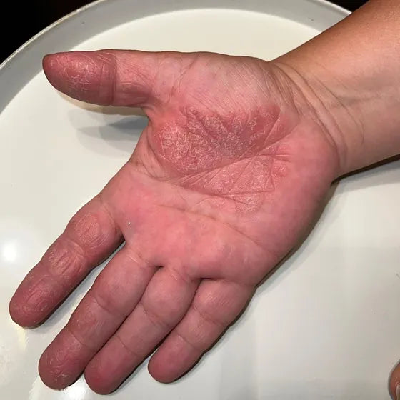 Customer photo, palm, before