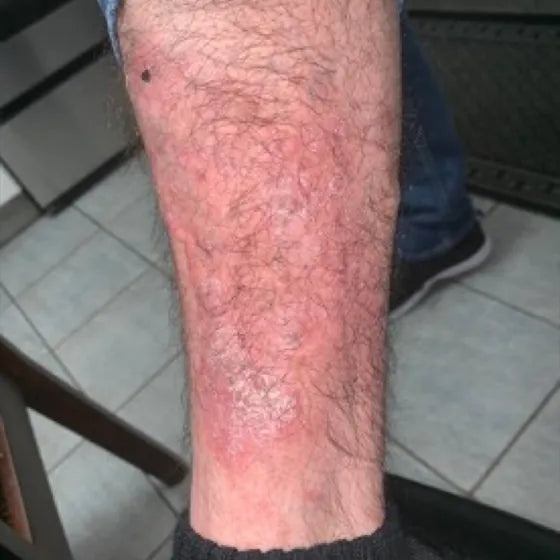Customer photo, shin, before