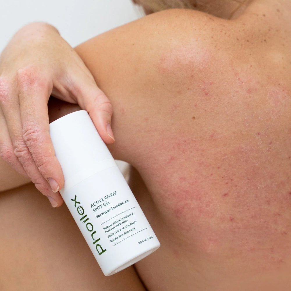 Phoilex Active ReLeaf Spot Gel Wins 2025 Shape Skin Awards!