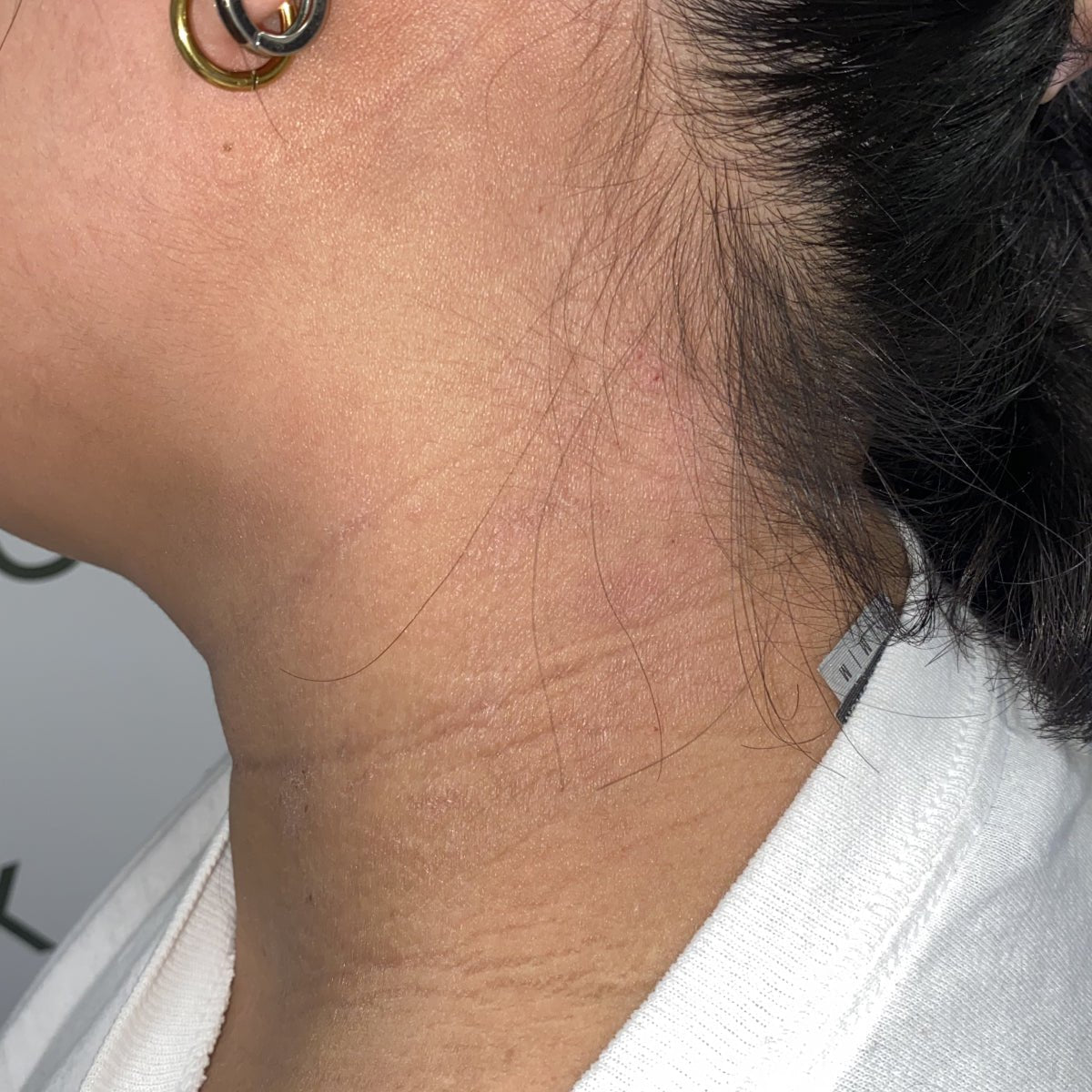 Calm Skin, Calm Life: A Holistic Guide for Eczema and Psoriasis - Phoilex