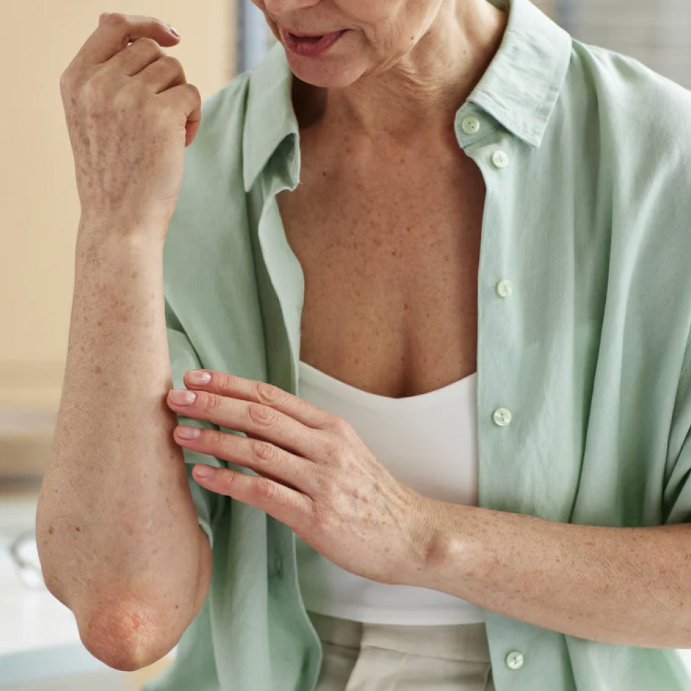 Eczema in Seniors: Causes, Symptoms, and Effective Treatments
