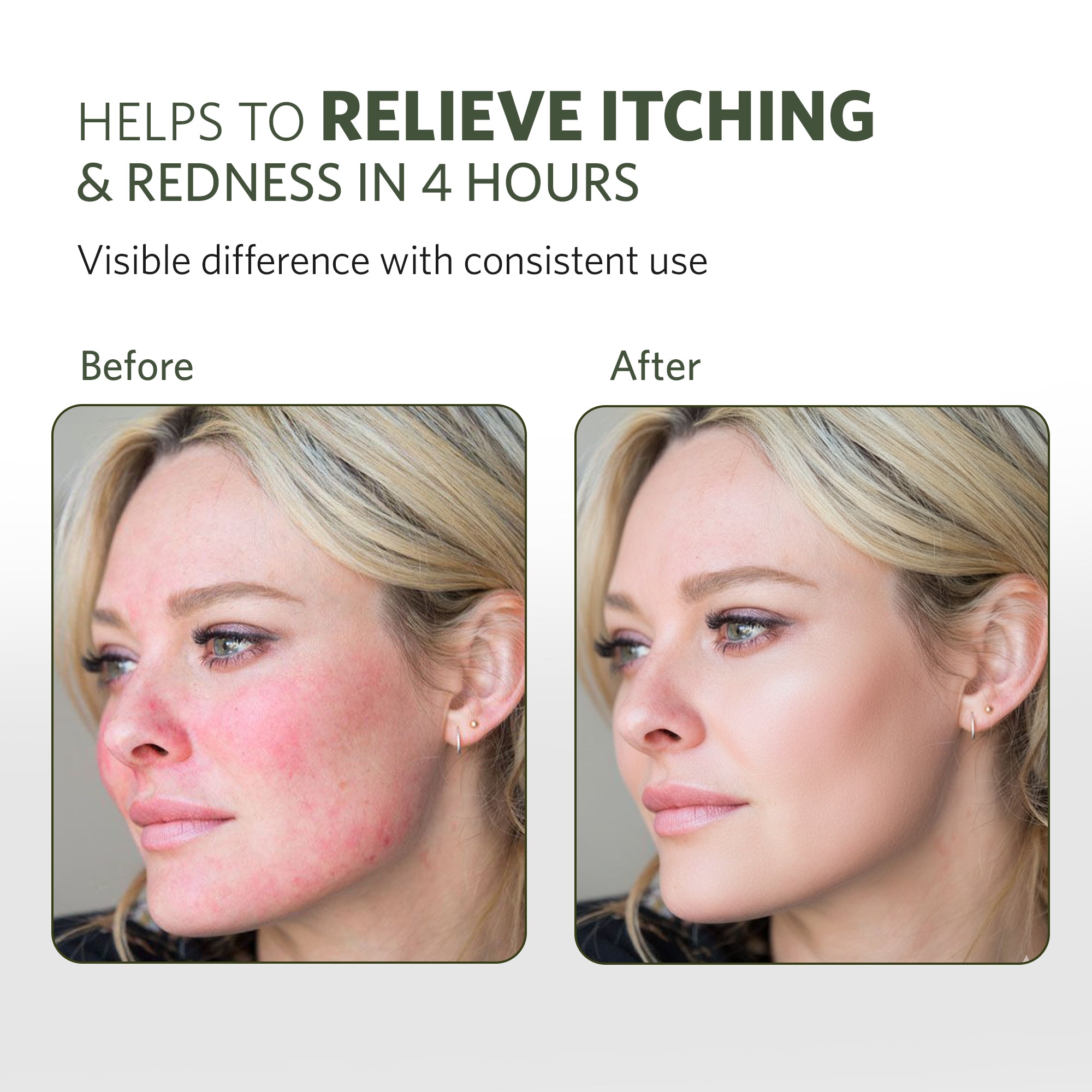Active ReLeaf Spot Gel