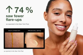 74% saw fewer flare-ups — as reported in the New York Post thumbnail