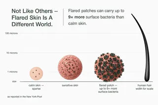 Flared skin carries up to 9x more surface bacteria than calm skin thumbnail