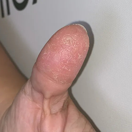 Customer photo, thumb, before