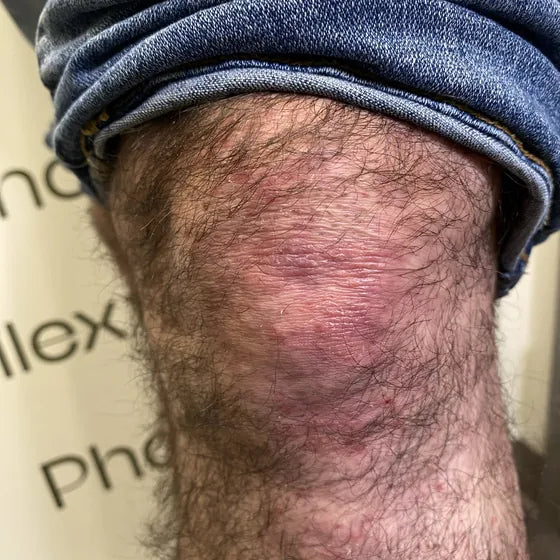 Customer photo, knee, before