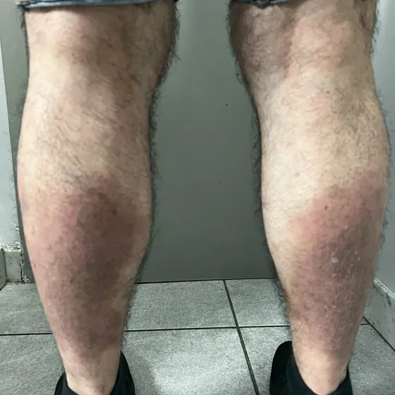 Customer photo, calf, after