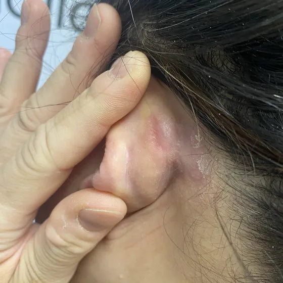 Customer photo, behind the ear, after