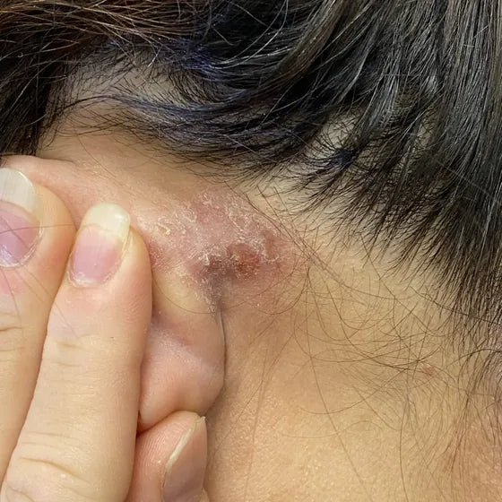 Customer photo, behind the ear, before