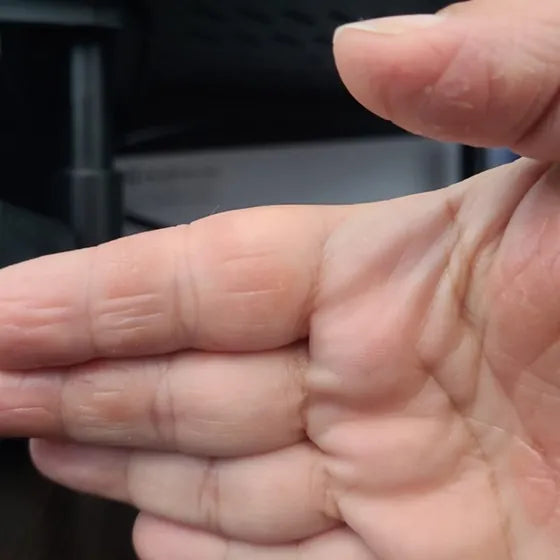 Customer photo, palm, after