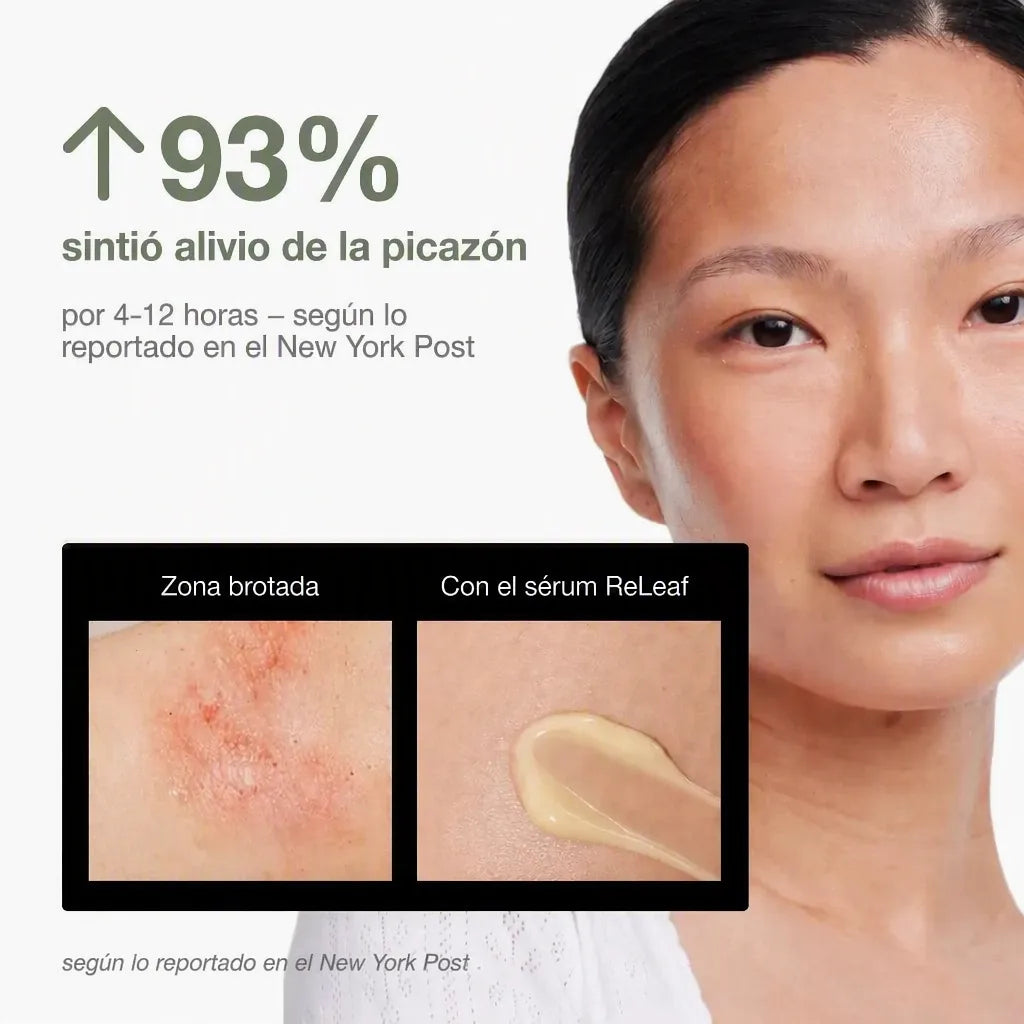 Phoilex Active ReLeaf Spot Gel — galería 6