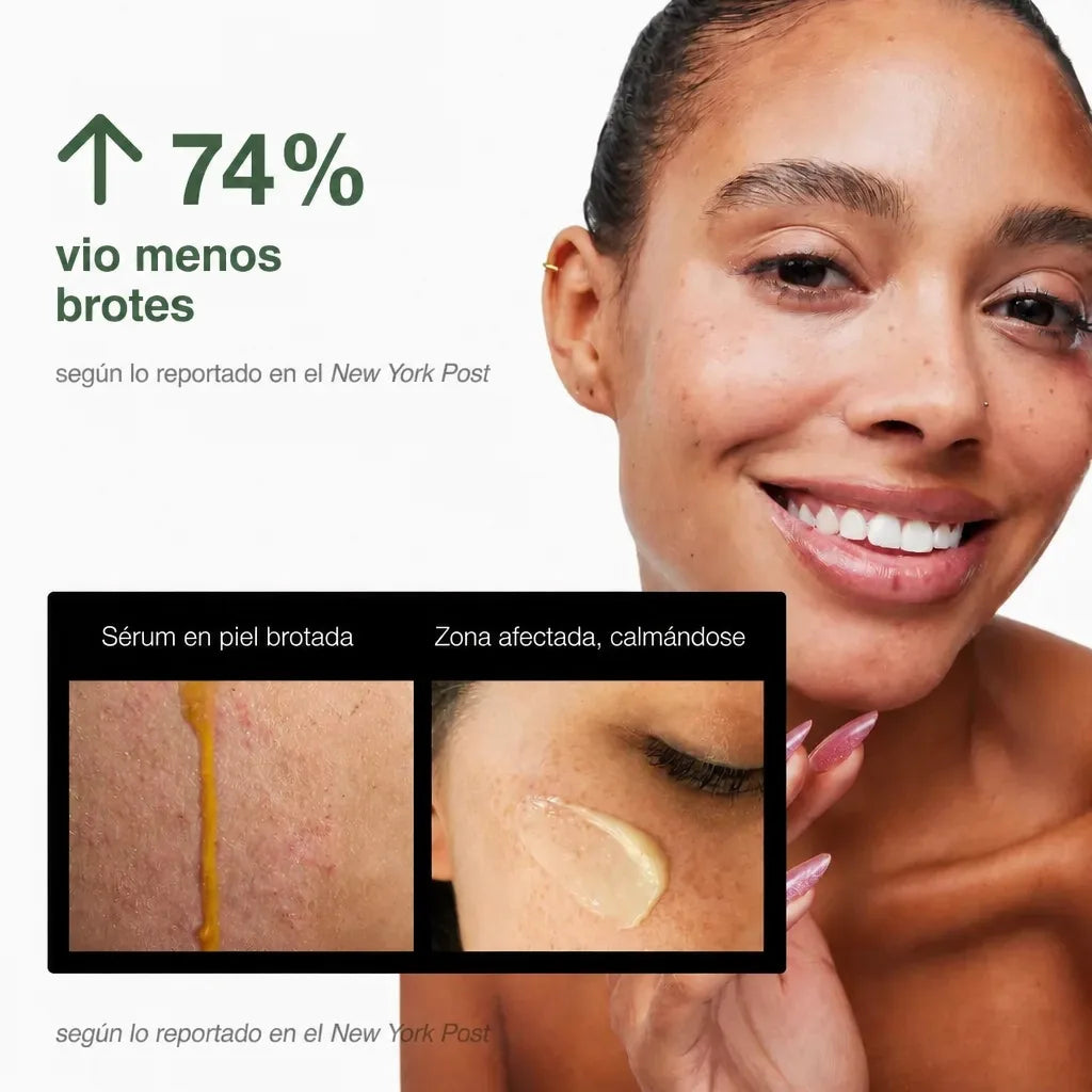 Phoilex Active ReLeaf Spot Gel — galería 7