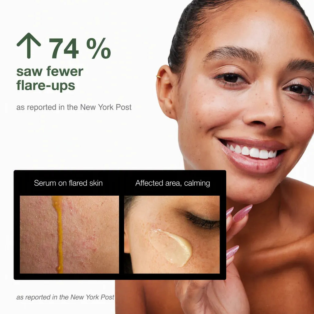 Phoilex Active ReLeaf Spot Gel — gallery 7